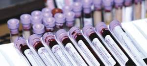 Blood sample vials